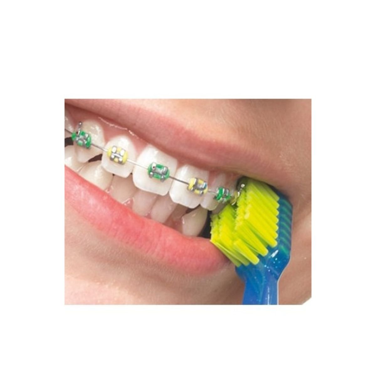 Curaprox Cs5460 Ortho Toothbrush
